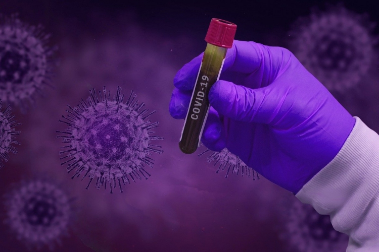 Akár 28 napig is fertőző maradhat az új koronavírus bizonyos felületeken 