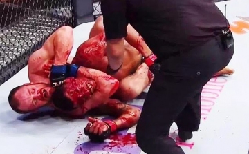 Vérfürdő az UFC-meccsen 
