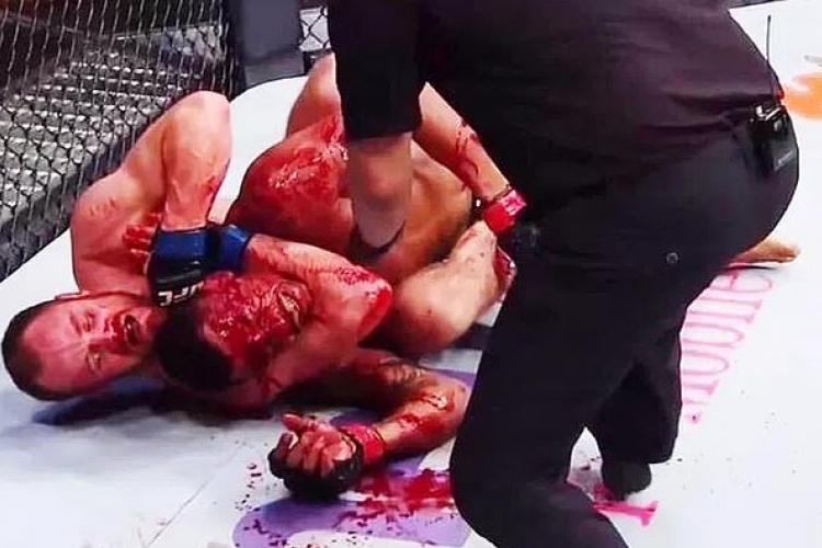 Vérfürdő az UFC-meccsen 
