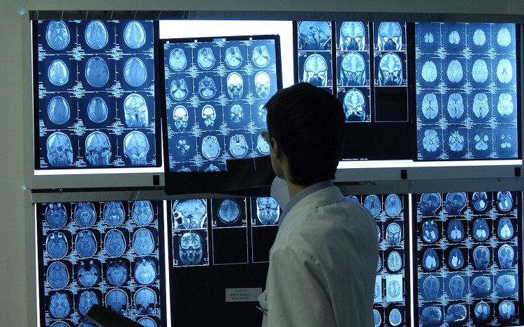 Képalkotó diagnosztika a rákgyóításban: a 800 milliós fejlesztés Győrt is érinti